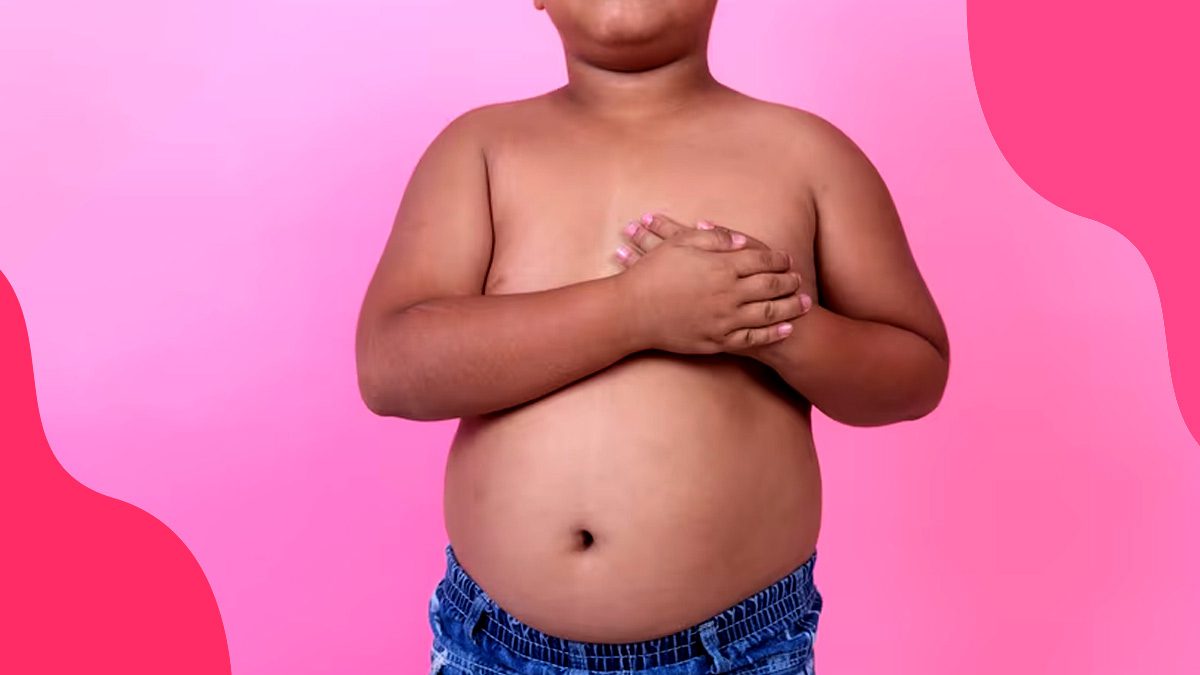 childhood obesity